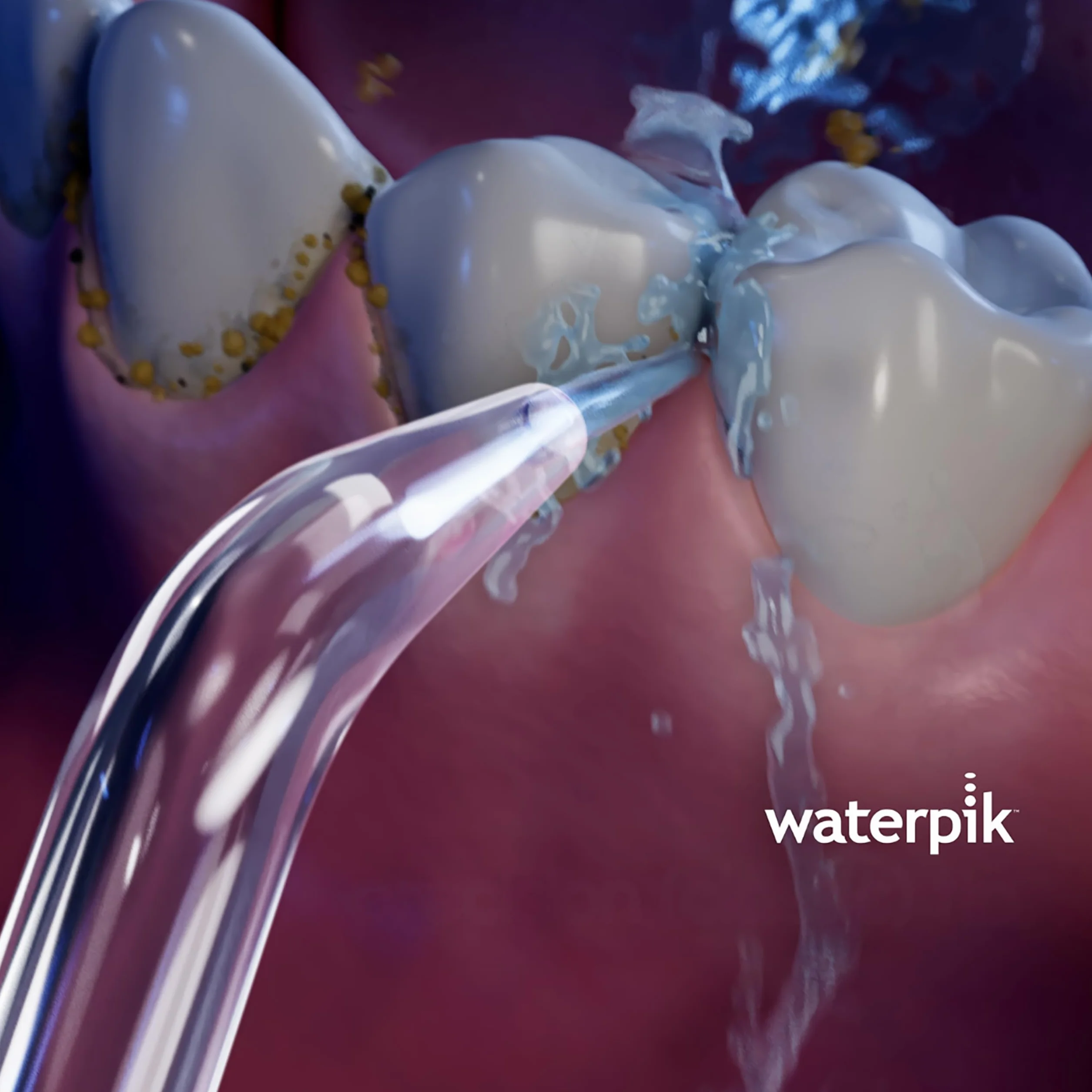 Waterpik Klasyczna końcówka wysokociśnieniowa, wymienne końcówki do użytku z irygatorami WP450 Cordless Plus, 2 sztuki (JT-450E)