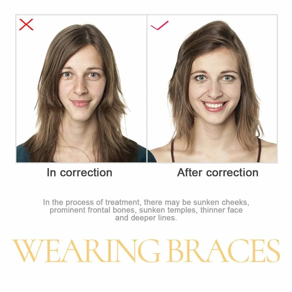 Invisalign Aligner Chewies 6 szt. Uciskarki do lejków ortodontycznych