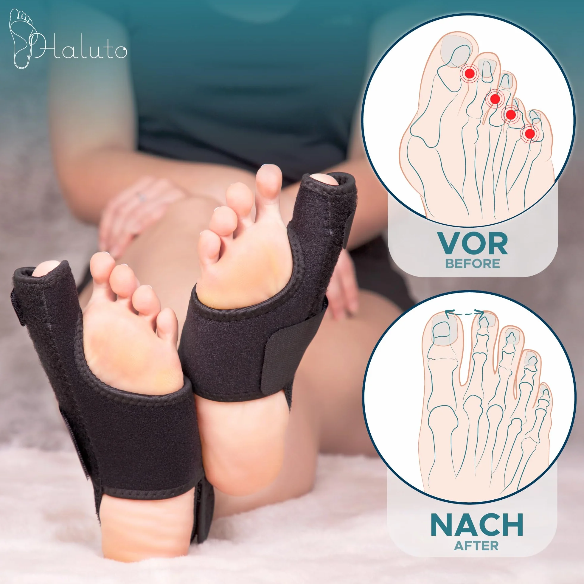 HALUTO Szyna na haluksy Hallux Valgus Correction Splint