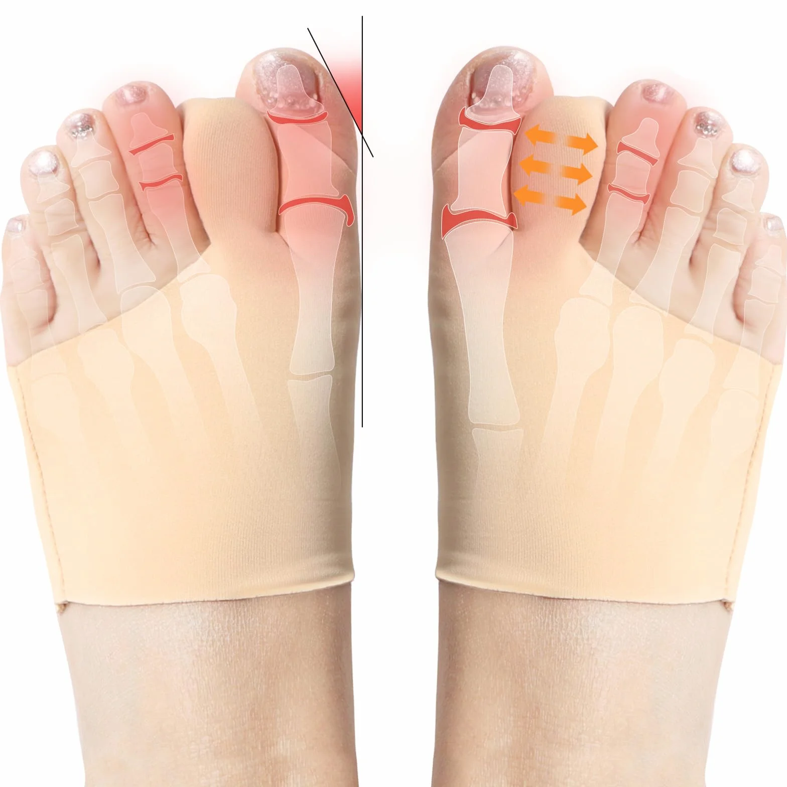 1 para orteza korekcyjna Hallux Valgus, opaska na Hallux Valgus, separator palców Hallux Valgus, skarpety Hallux Valgus do łagodzenia bólu, wbudowane, wyjmowane silikonowe amortyzatory