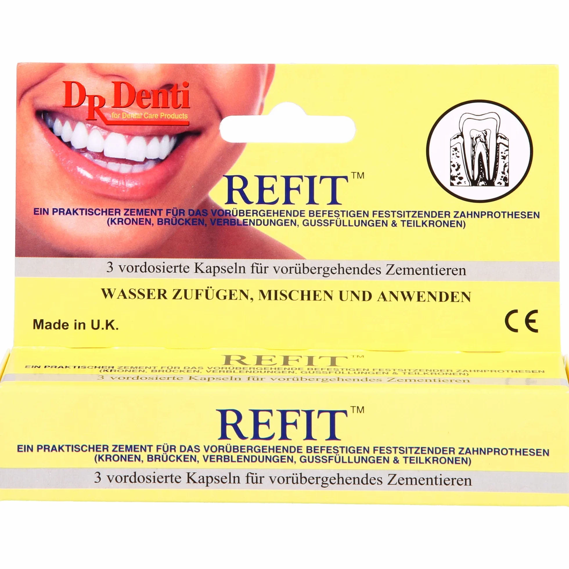 Refit tymczasowe kapsułki z klejem dentystycznym, 1 opakowanie 3 kapsułek