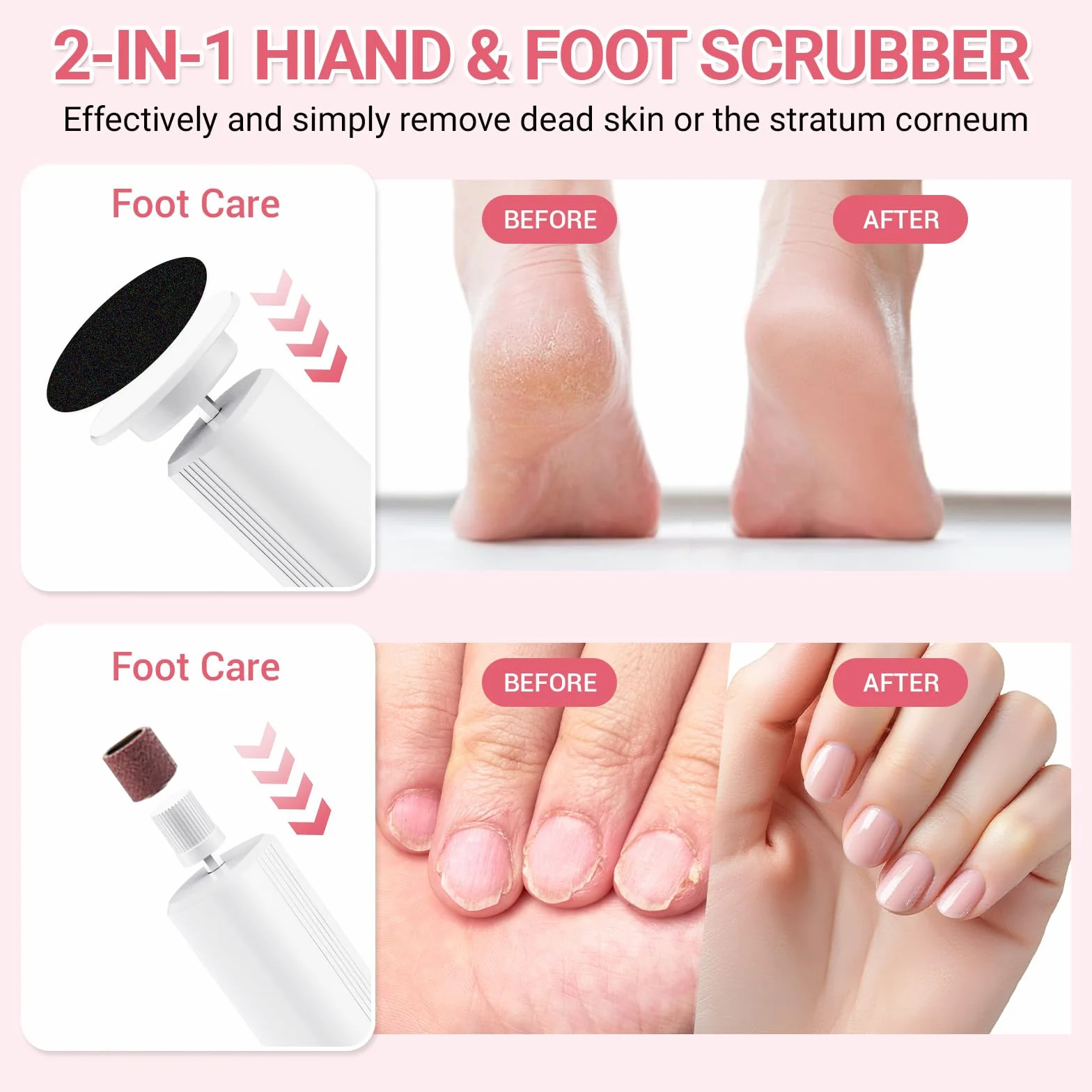 Elektryczny Usuwacz Zrogowaciałej Skóry, 2 w 1 Zestaw do Pedicure z 6 Regulacjami, Ładowanie przez Podstawkę, dla Spękanych Pięt, Zrogowaceń i Twardej Skóry